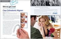 Clear Aligners - Dear Doctor Magazine